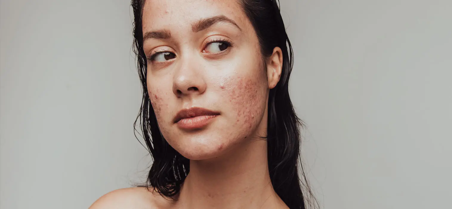 The BioHacking Clinic - Understanding the Role of DNA in Skin Health